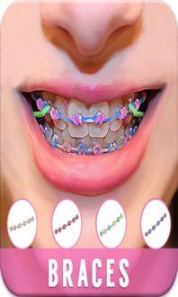 牙套拍照网红拍照,网红牙套拍照新风尚