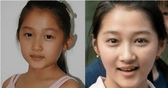 小时候长得丑的明星,盘点小时候长得丑的明星蜕变之路