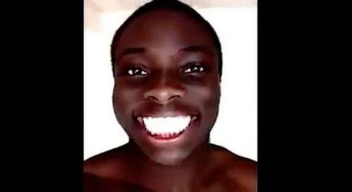 非洲网红牙,闪耀非洲的微笑传奇