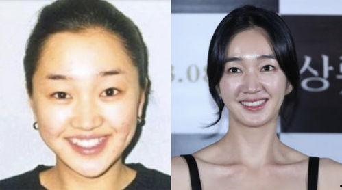 韩国明星牙齿白,韩国明星牙齿美白秘诀大揭秘